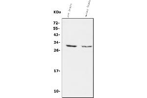 Western blot analysis of Calretinin/CALB2 using anti-Calretinin/CALB2 antibody (ABIN7603109).