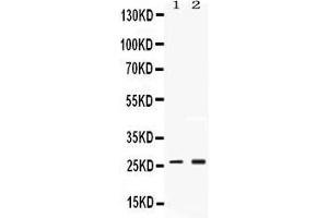 Western blot analysis of PSMA2 expression in rat testis extract ( Lane 1) and MCF-7 whole cell lysates ( Lane 2). (PSMA2 anticorps  (Middle Region))