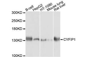 Western blot analysis of extracts of various cell lines, using CYFIP1 antibody. (CYFIP1 anticorps  (AA 1-270))