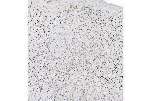 IHC analysis of hnRNP D/AUF1/HNRNPD using anti-hnRNP D/AUF1/HNRNPD antibody (ABIN7602592). (HNRNPD/AUF1 anticorps  (AA 88-246))