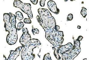 IHC analysis of B Raf/BRAF using anti-B Raf/BRAF antibody (ABIN3043761). (BRAF anticorps  (AA 38-230))
