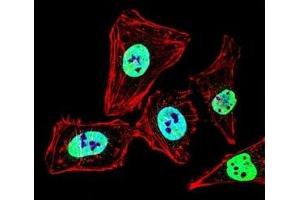 Fluorescent confocal image of HeLa cell stained with HDAC2 antibody at 1:25. (HDAC2 anticorps  (AA 410-439))