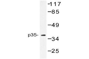 Image no. 1 for anti-Cyclin-Dependent Kinase 5, Regulatory Subunit 1 (p35) (CDK5R1) antibody (ABIN272233) (CDK5R1 anticorps)