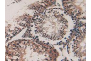 IHC-P analysis of Mouse Testis Tissue, with DAB staining. (MAP1A anticorps  (AA 2552-2759))