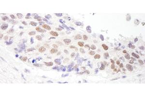 Immunohistochemistry (IHC) image for anti-Histone Deacetylase 3 (HDAC3) (C-Term) antibody (ABIN7453872)