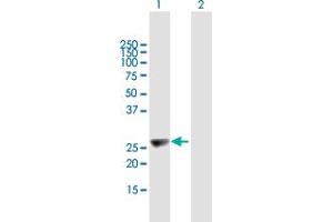 Western Blot analysis of KIFC2 expression in transfected 293T cell line by KIFC2 MaxPab polyclonal antibody. (KIFC2 anticorps  (AA 1-226))
