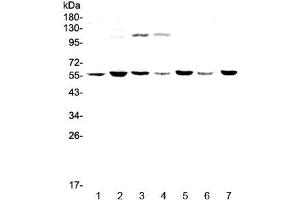 Western blot testing of human 1) HeLa, 2) MDA-MB-453, 3) Jurkat, 4) HepG2, 5) SK-OV-3, 6) PANC-1 and 7) mouse thymus lysate with CHRNA3 antibody at 0. (CHRNA3 anticorps)