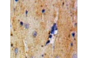 Used in DAB staining on fromalin fixed paraffin-embedded Heart tissue (Lactate Dehydrogenase A anticorps  (AA 1-332))