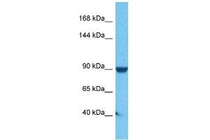 Host:  Rabbit  Target Name:  Atp6v0a1  Sample Tissue:  Human DLD1 Whole Cell  Antibody Dilution:  1ug/ml