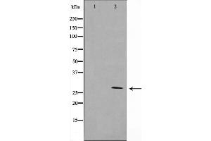 Western blot analysis of 14-3-3 zeta/delta expression in K562 whole cell lysates,The lane on the left is treated with the antigen-specific peptide. (14-3-3 zeta anticorps  (C-Term))