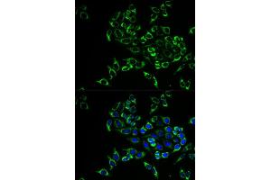 Immunofluorescence analysis of HeLa cells using RANKL antibody (ABIN6127581, ABIN6149337, ABIN6149338 and ABIN6217616).