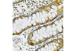 Immunohistochemistry of paraffin-embedded human colon using HSP90AB1 Antibody.