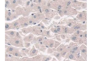 Detection of FUT6 in Human Liver Tissue using Polyclonal Antibody to Fucosyltransferase 6 (FUT6)