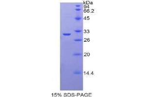 SDS-PAGE analysis of Rat Lactoperoxidase Protein. (LPO Protéine)