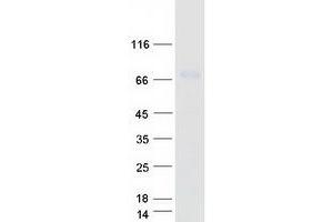 Validation with Western Blot