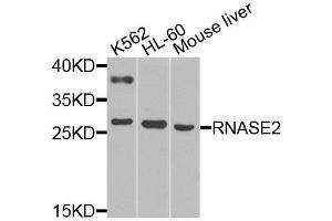 Western blot analysis of extracts of various cell lines, using RNASE2 antibody (ABIN6003657) at 1/1000 dilution. (RNASE2 anticorps)
