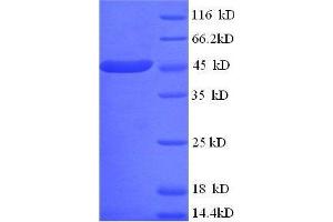 Creatine Kinase, Mitochondrial 1, Ubiquitous (CKMT1) (AA 40-417), (full length) protein (His tag)