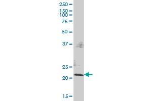 PMVK MaxPab polyclonal antibody.