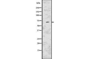 Western blot analysis of KCND2 using MCF7 whole  lysates.