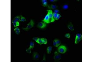 Immunofluorescence staining of MCF-7 cells with ABIN7156430 at 1:200, counter-stained with DAPI.