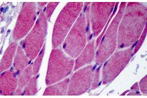 Human Skeletal Muscle: Formalin-Fixed, Paraffin-Embedded (FFPE) (TRPC3 anticorps  (C-Term))