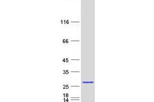 Validation with Western Blot