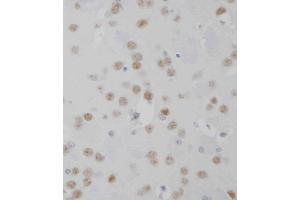 D staining MeCP2 in mouse brain tissue sections by Immunohistochemistry (IHC-P - paraformaldehyde-fixed, paraffin-embedded sections). (MECP2 anticorps  (AA 400-428))
