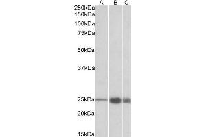 ABIN1590144 (1 µg/mL) staining of Human (A), Mouse(B) and Rat (C) Skeletal Muscle lysate (35 µg protein in RIPA buffer). (TNNI2 anticorps  (AA 83-95))