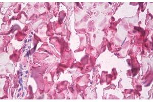 Image no. 1 for anti-Collagen, Type V, alpha 1 (COL5A1) antibody (ABIN1502288)