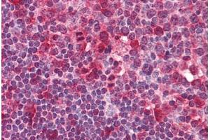 Human Tonsil (formalin-fixed, paraffin-embedded) stained with SYK antibody ABIN239825 at 5 ug/ml followed by biotinylated anti-mouse IgG secondary antibody ABIN481714, alkaline phosphatase-streptavidin and chromogen. (SYK anticorps  (AA 5-360))