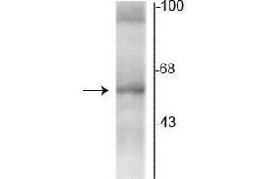 Western blot of rat hippocampal lysate showing specific immunolabeling of the ~58 kDa TR-α2 protein. (THRA anticorps  (C-Term))