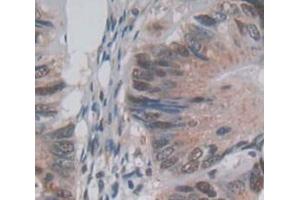 IHC-P analysis of Human Tissue, with DAB staining. (PKN2 anticorps  (AA 67-312))
