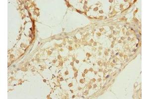 Immunohistochemistry of paraffin-embedded human testis tissue using ABIN7146273 at dilution of 1:100 (Calcineurin B anticorps  (AA 1-170))