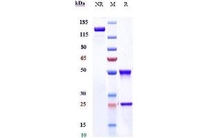 Anti-LEPR / CD295 Reference Antibody (mibavademab) on SDS-PAGE under reducing (R) condition.