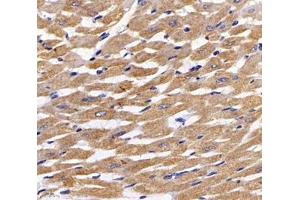 Immunofluorescent analysis of paraformaldehyde-fixed rat heart using,MYBPC3 (ABIN7074729) at dilution of 1: 2000