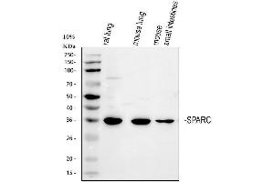 Western blot analysis of SPARC using anti-SPARC antibody (ABIN6719585).