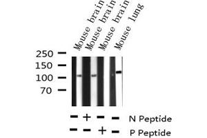 Western blot analysis of Phospho-B-RAF (Ser446) expression in various lysates (BRAF anticorps  (pSer446))