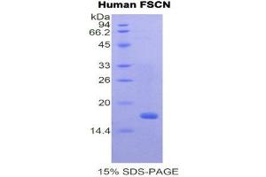 SDS-PAGE (SDS) image for Fascin (FSCN1) (AA 277-396) protein (His tag) (ABIN2121005)