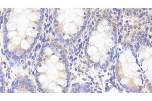 anti-Dual-Specificity tyrosine-(Y)-phosphorylation Regulated Kinase 1A (DYRK1A) (AA 16-300) antibody