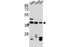 Western Blotting (WB) image for anti-Heterogeneous Nuclear Ribonucleoprotein C (C1/C2) (HNRNPC) antibody (ABIN2995806) (HNRNPC anticorps)