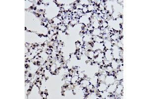 Immunohistochemistry of paraffin-embedded mouse lung using Acetyl-Histone H3-K27 Rabbit mAb (ABIN3016650, ABIN3016651, ABIN3016652, ABIN1682513 and ABIN1682514) at dilution of 1:100 (40x lens).