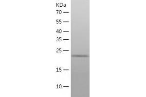 Fibroblast Growth Factor 23 (FGF23) (AA 25-251) protein (His tag)