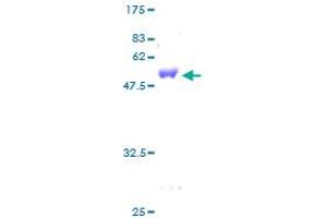 Glutathione Transferase zeta 1 (Maleylacetoacetate Isomerase) (GSTZ1) (AA 1-216) protein (GST tag)