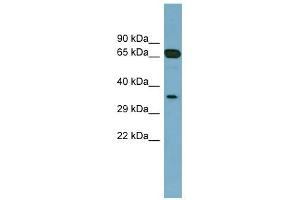 GLOD4 antibody used at 1 ug/ml to detect target protein. (GLOD4 anticorps  (Middle Region))