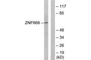 Western blot analysis of extracts from Jurkat cells, using ZNF668 Antibody. (ZNF668 anticorps  (AA 271-320))