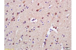 Formalin-fixed and paraffin embedded rat brain labeled with Anti-AKAP7 Polyclonal Antibody, Unconjugated (ABIN1387303) at 1:200 followed by conjugation to the secondary antibody and DAB staining (AKAP7 anticorps  (AA 31-80))