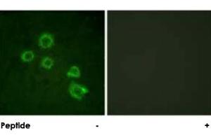 Immunofluorescence analysis of HUVEC cells, using PLA2G4A polyclonal antibody . (PLA2G4A anticorps)