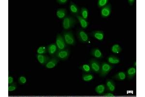 Immunofluorescence staining of Hela cells with ABIN7140239 at 1:50, counter-stained with DAPI.