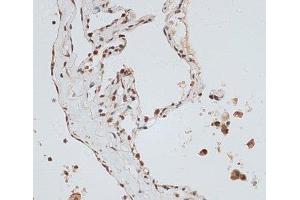 Immunohistochemistry of paraffin-embedded Human lung using ZNF148 Polyclonal Antibody at dilution of 1:100 (40x lens).