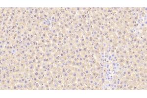 Detection of TFR in Rat Liver Tissue using Polyclonal Antibody to Transferrin Receptor (TFR) (Transferrin Receptor anticorps  (AA 587-756))